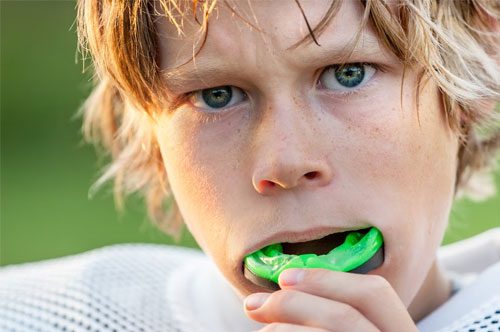 Play Safely With Custom Athletic Mouthguards for Kids