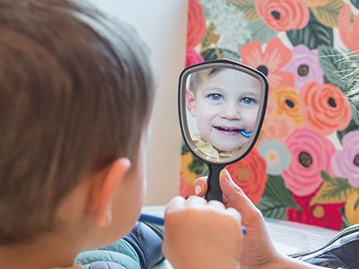 Silver Diamine Fluoride (SDF)