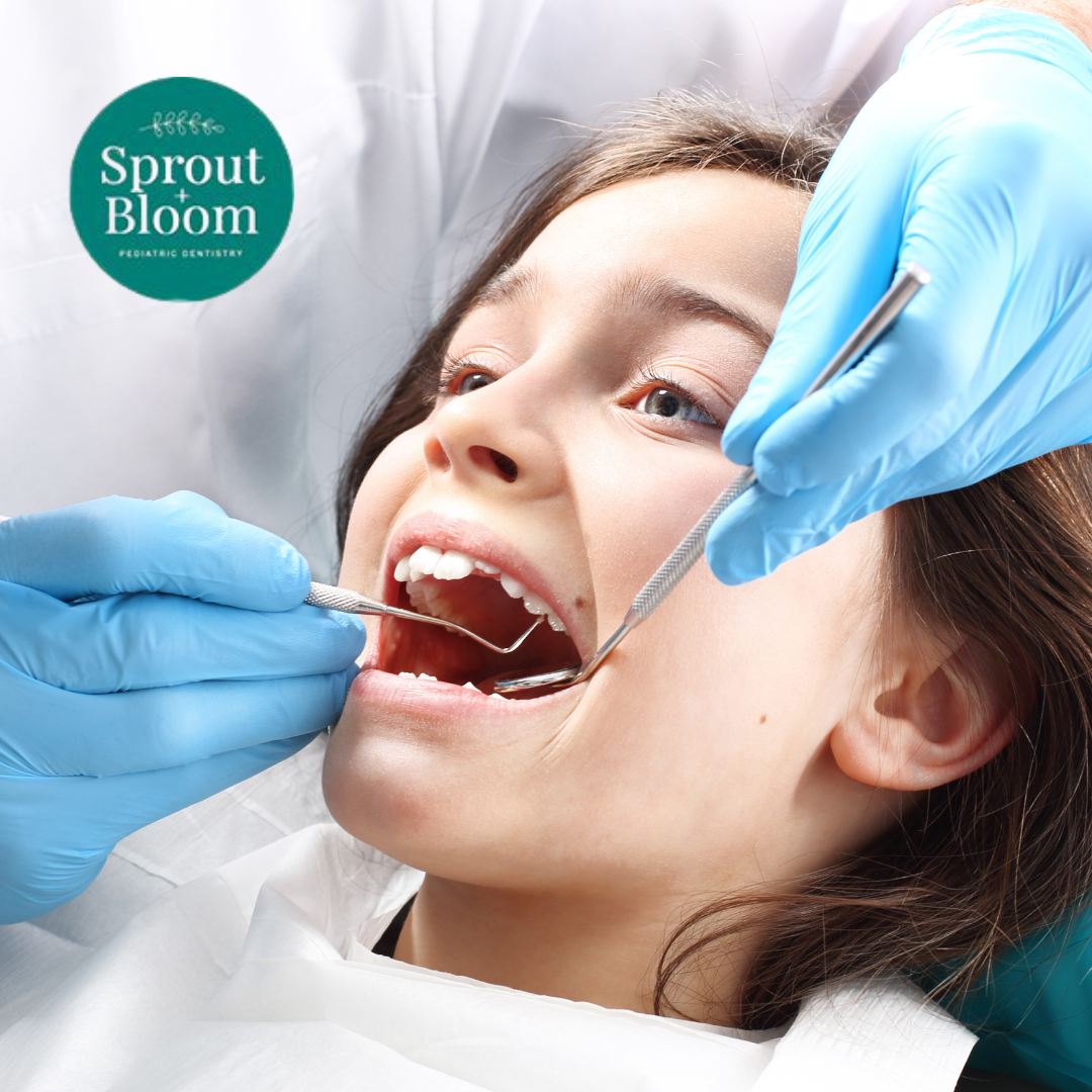 How Do Dental Sealants Work for Kids?